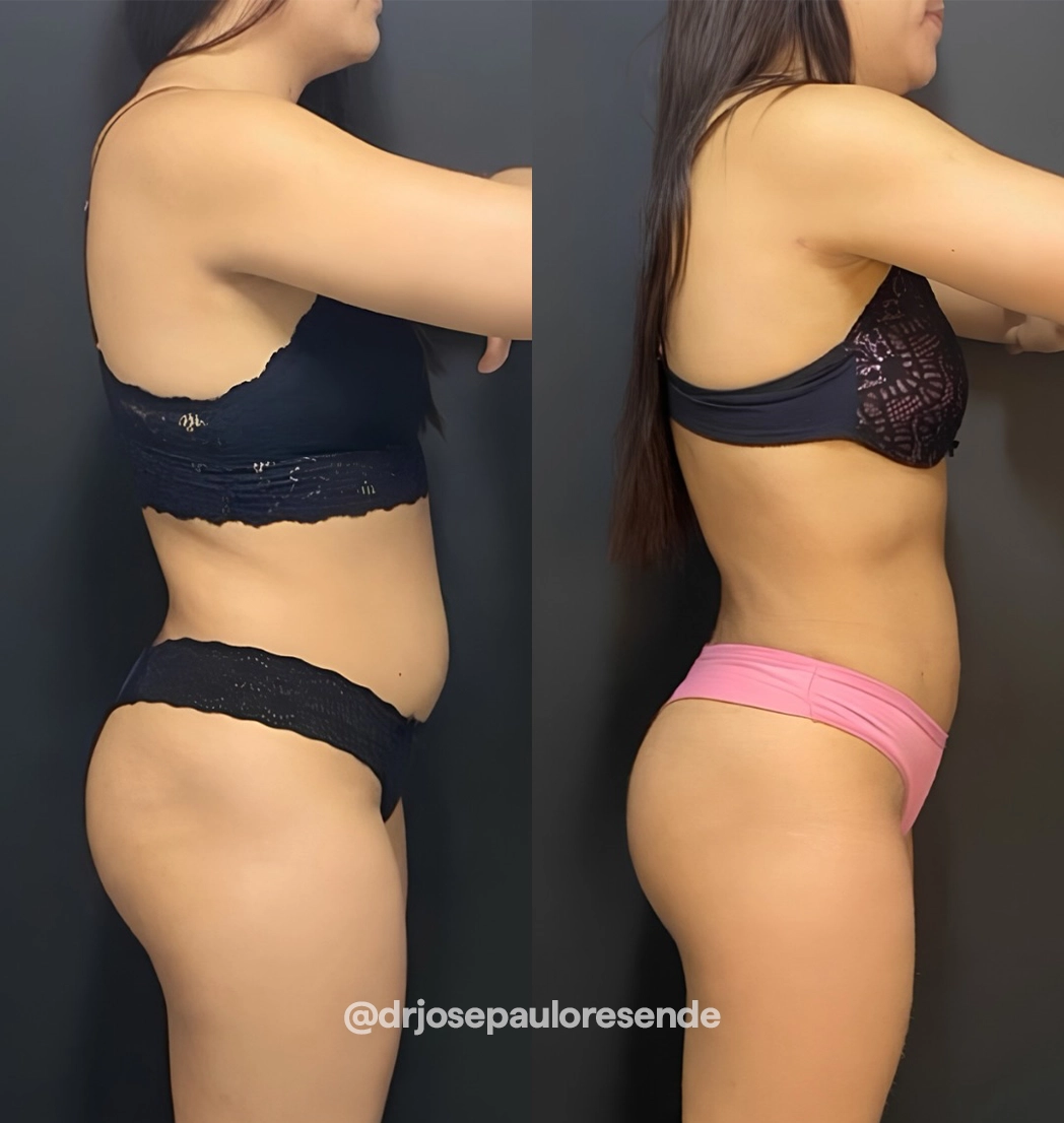 resultado 1 - dr josé